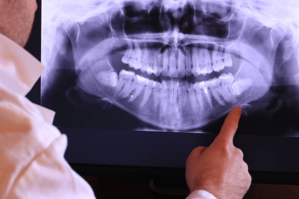 Best Tooth Infection Emergency Dentist  in Burkesville, KY