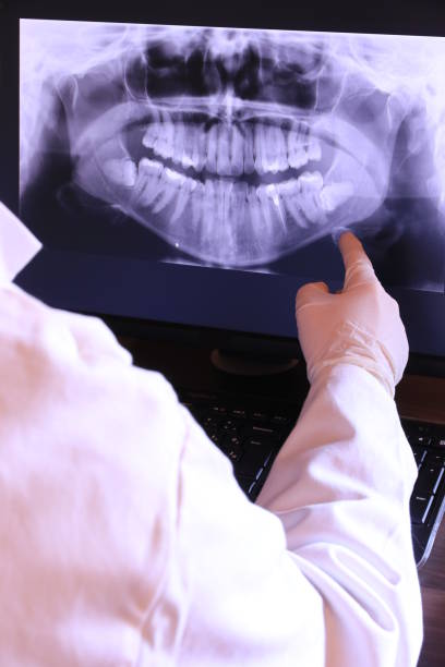 Best Chipped Tooth Repair Near Me  in Burkesville, KY