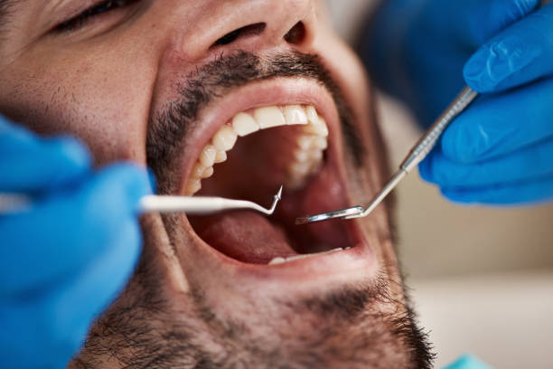 Best Tooth Infection Emergency Dentist  in Burkesville, KY