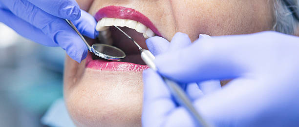 Best Dentist for Tooth Abscess  in Burkesville, KY